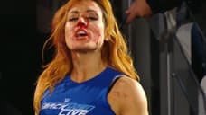 Becky Lynch Shares A Look At The Treatment She's Undergoing For Recent Injuries