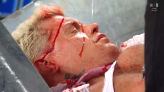 Randy Orton Leaves Cody Rhodes A Bloody Mess On SmackDown