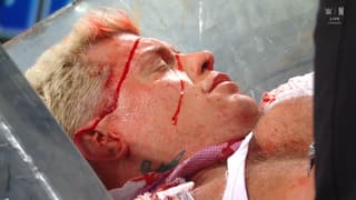 Randy Orton Leaves Cody Rhodes A Bloody Mess On SmackDown
