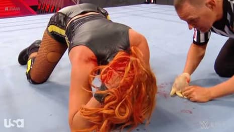 Shayna Baszler Attacks Becky Lynch On RAW And... Sinks Her Teeth Into The Back Of Her Neck!
