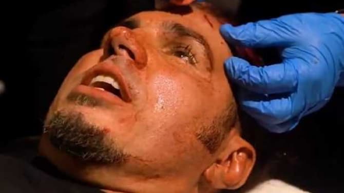 Matt Hardy Required 13 Stitches After Being Busted Open By Sammy Guevara On AEW DYNAMITE