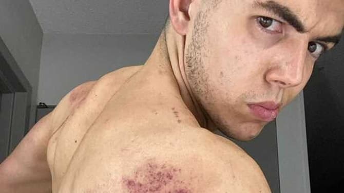 Sammy Guevara Shows Off Horrific BLOOD AND GUTS Injuries As DYNAMITE Ranks #1 On Cable For First Time