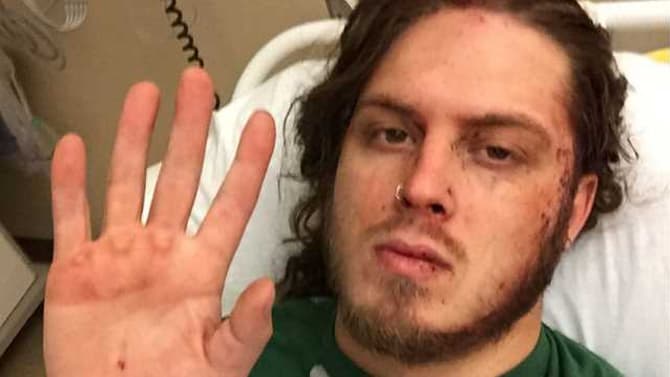 Joey Janela Updates Fans On His Knee Injury And When They Can Expect Him Back In The Ring