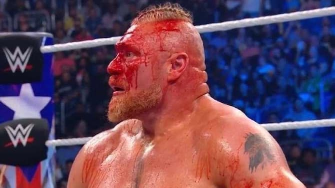 Why Was Brock Lesnar Allowed To Bleed At WWE BACKLASH? It Sounds Like He Plays By His Own Rules