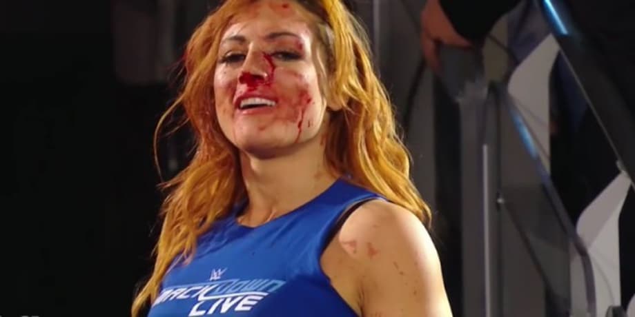 Becky Lynch Issues A Brilliant Response To Being Busted Open During Last Night's RAW