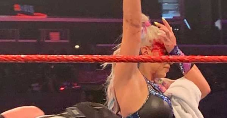 A WWE MAIN EVENT Match Had To Be Stopped After Dana Brooke Was Badly Busted Open