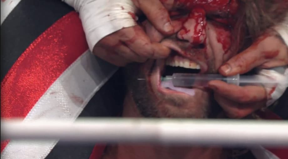 "Hangman" Adam Page Can No Longer Fight For The AEW World Championship Ever Again