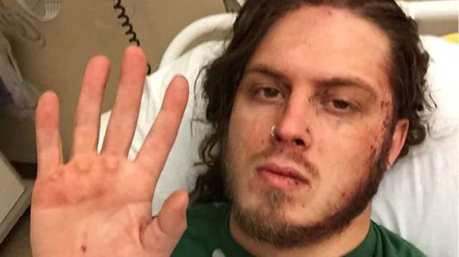 Joey Janela Updates Fans On His Knee Injury And When They Can Expect Him Back In The Ring