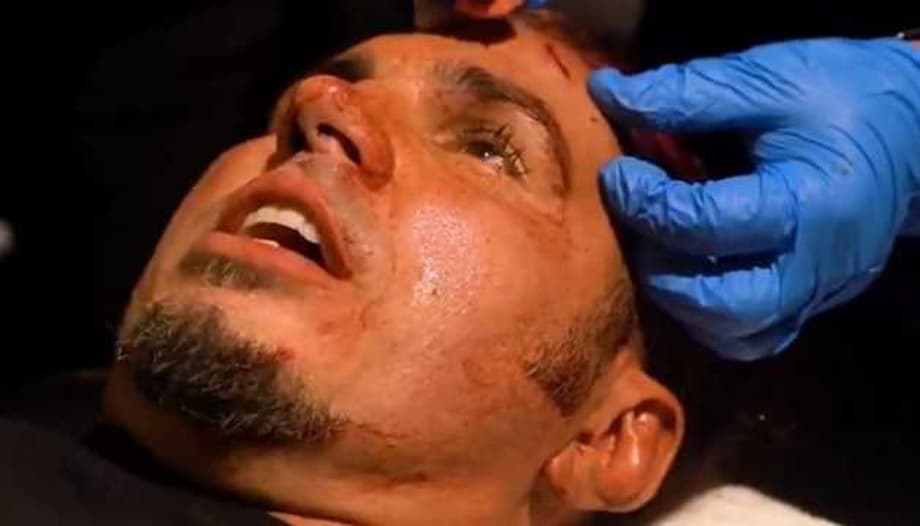 Matt Hardy Required 13 Stitches After Being Busted Open By Sammy Guevara On AEW DYNAMITE