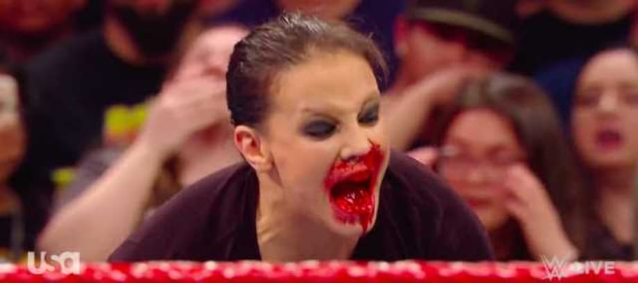Shayna Baszler Shares A Bloody Photo In Response To Her Vicious Attack On Becky Lynch On RAW