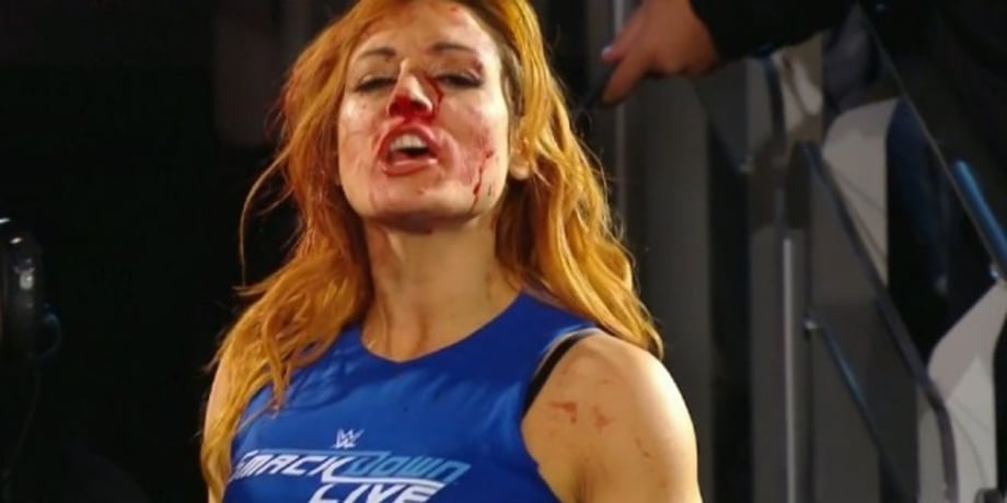 Becky Lynch Shares A Look At The Treatment She's Undergoing For Recent Injuries