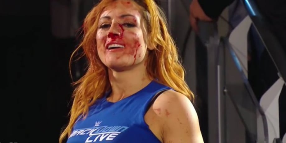 Becky Lynch Issues A Brilliant Response To Being Busted Open During Last Night's RAW