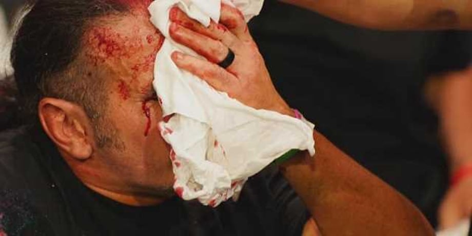 Chris Jericho Shares His Thoughts On Matt Hardy Being Busted Open On AEW: DYNAMITE Last Week