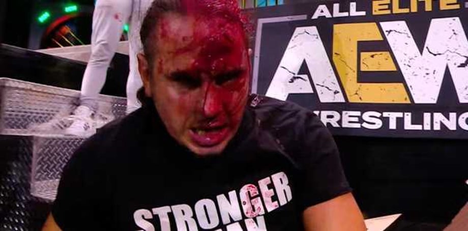 Matt Hardy Was Badly Busted Open On AEW DYNAMITE Following An Attack From Sammy Guevara