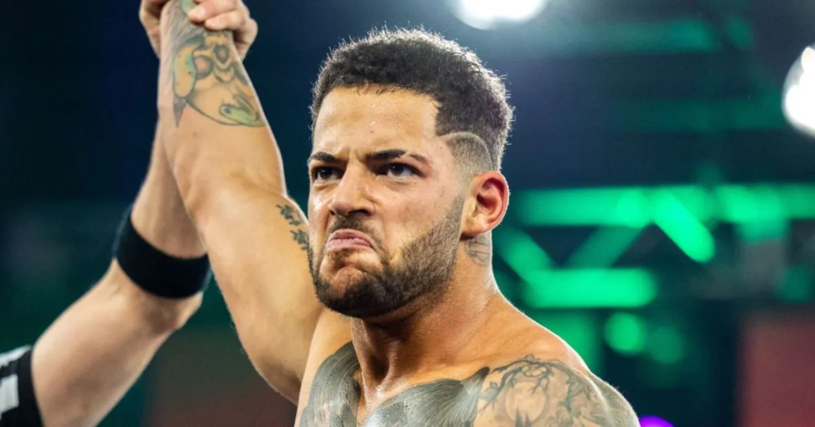 Trey Miguel Posts An Update About The Status Of His Injury